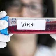 Crece el VIH en Argentina: aumento de casos y diagnósticos que llegan demasiado tarde