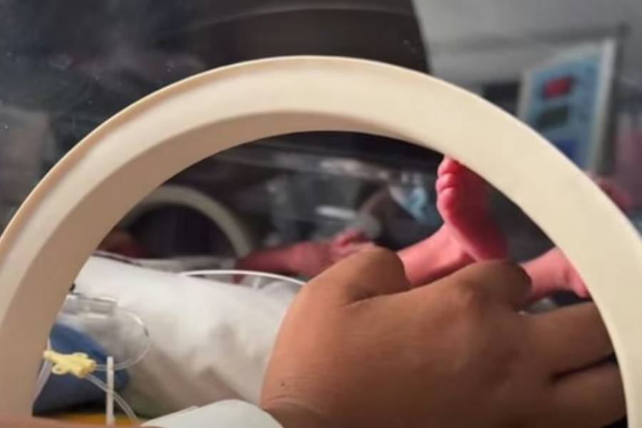 Nacieron trigemelas en Chubut, un “milagro” que ocurre una vez cada millones de embarazos