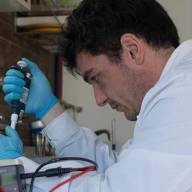 Científicos descubren cómo el cáncer renal modifica la grasa que lo rodea